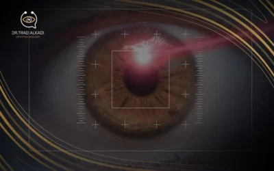 Key Differences Between LASEK and LASIK Surgery