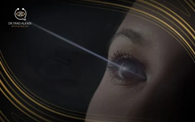  كل ما تود معرفته عن عملية الليزر السطحي prk لتصحيح النظر