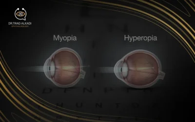 Myopia vs Hyperopia: Seeing the World Through Different Views