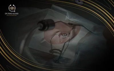 كيف تُحدد تكلفة عملية المياه البيضاء؟