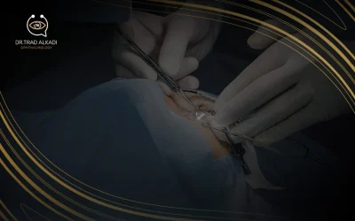 عملية زرع الحلقات للقرنية المخروطية