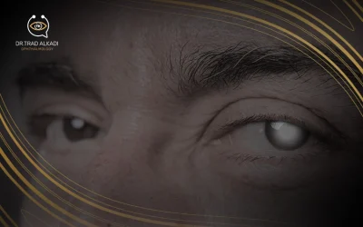المياه البيضاء في العين| أسبابها وأعراضها ووسائل علاجها
