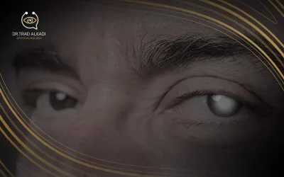 المياه البيضاء في العين| أسبابها وأعراضها ووسائل علاجها 